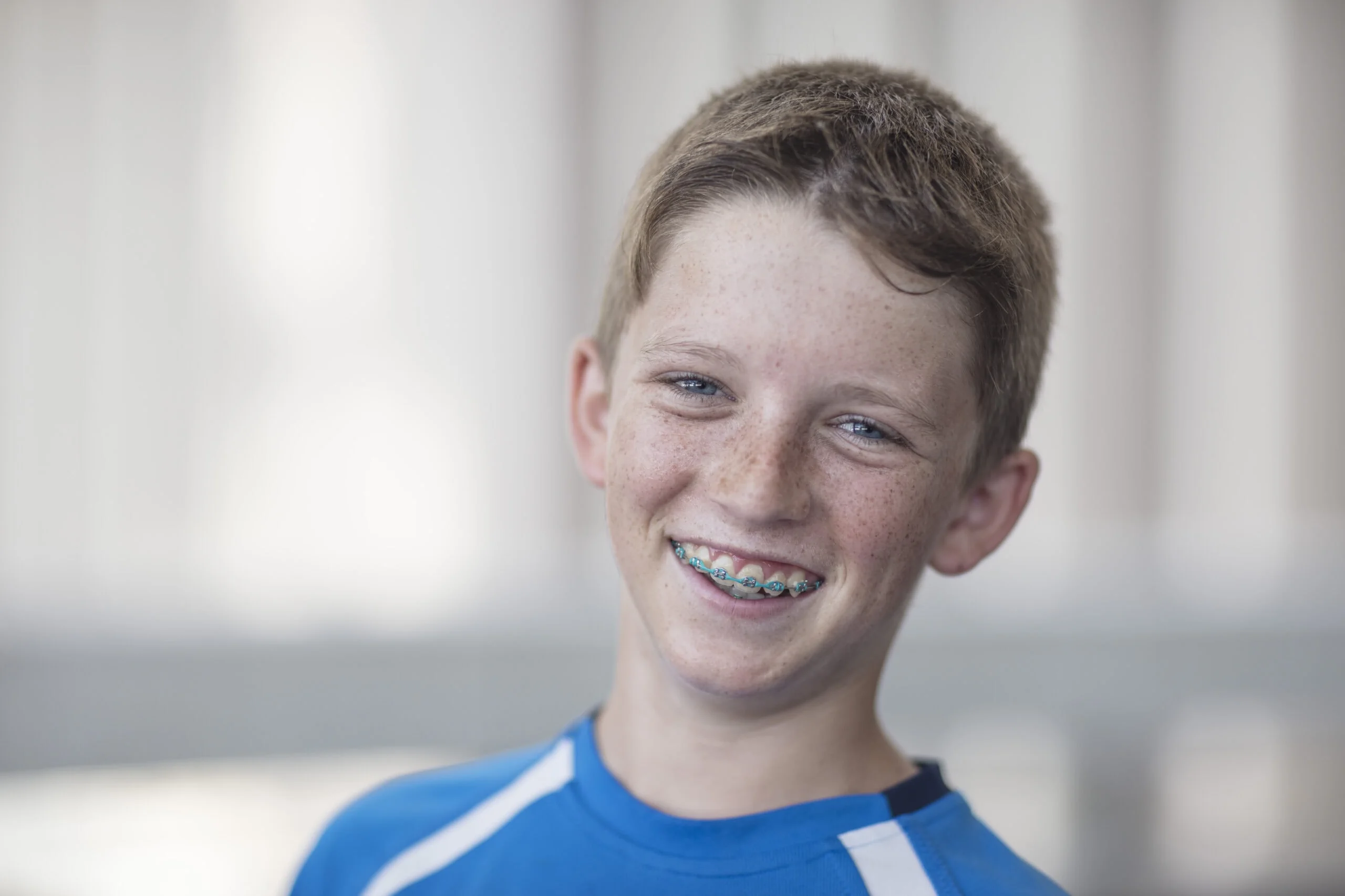 portrait of smiling boy with braces 2022 03 08 01 36 47 utc scaled - Smile! The Colorful World of Power Chains and Braces